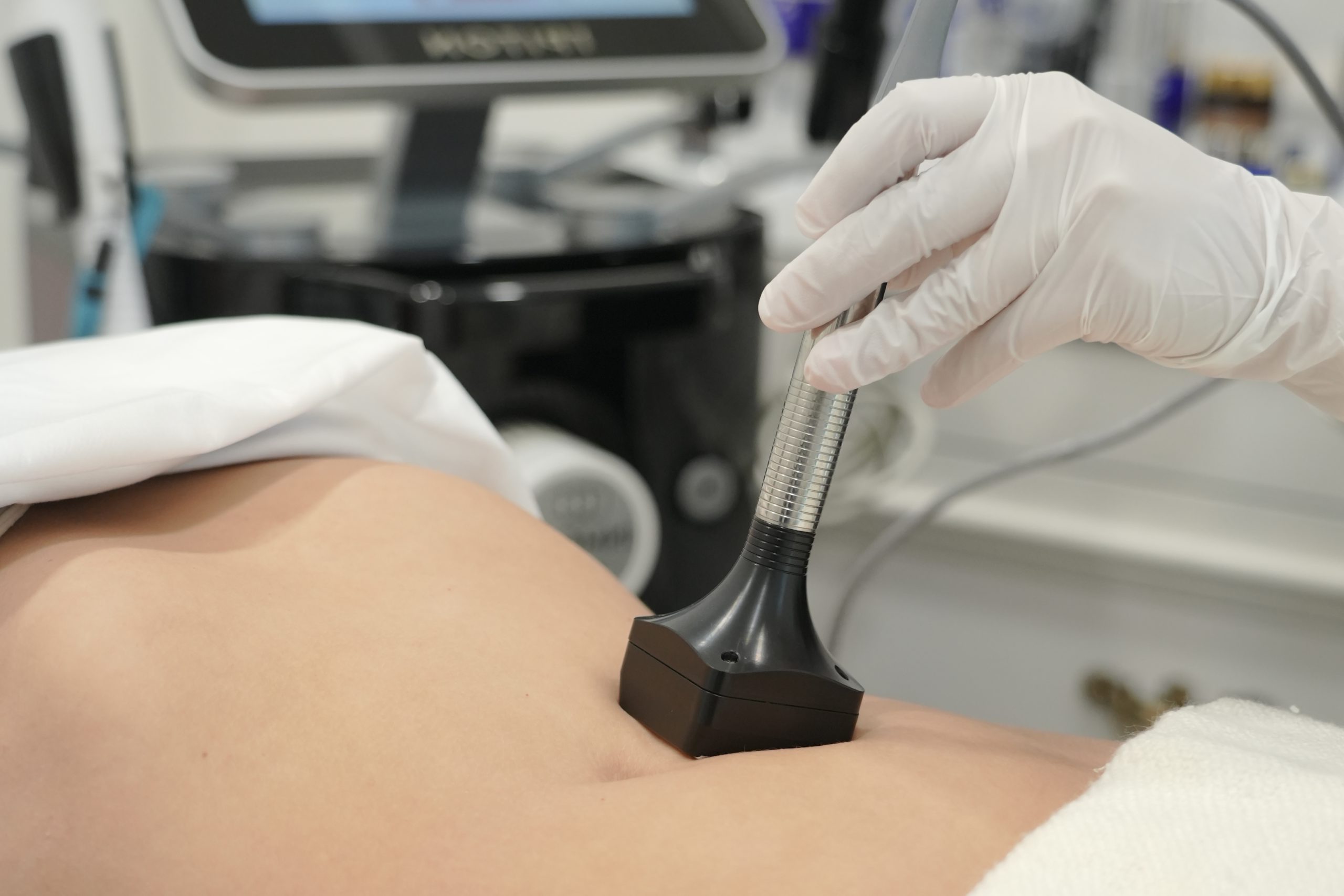 Professional microdermabrasion skin polishing treatment