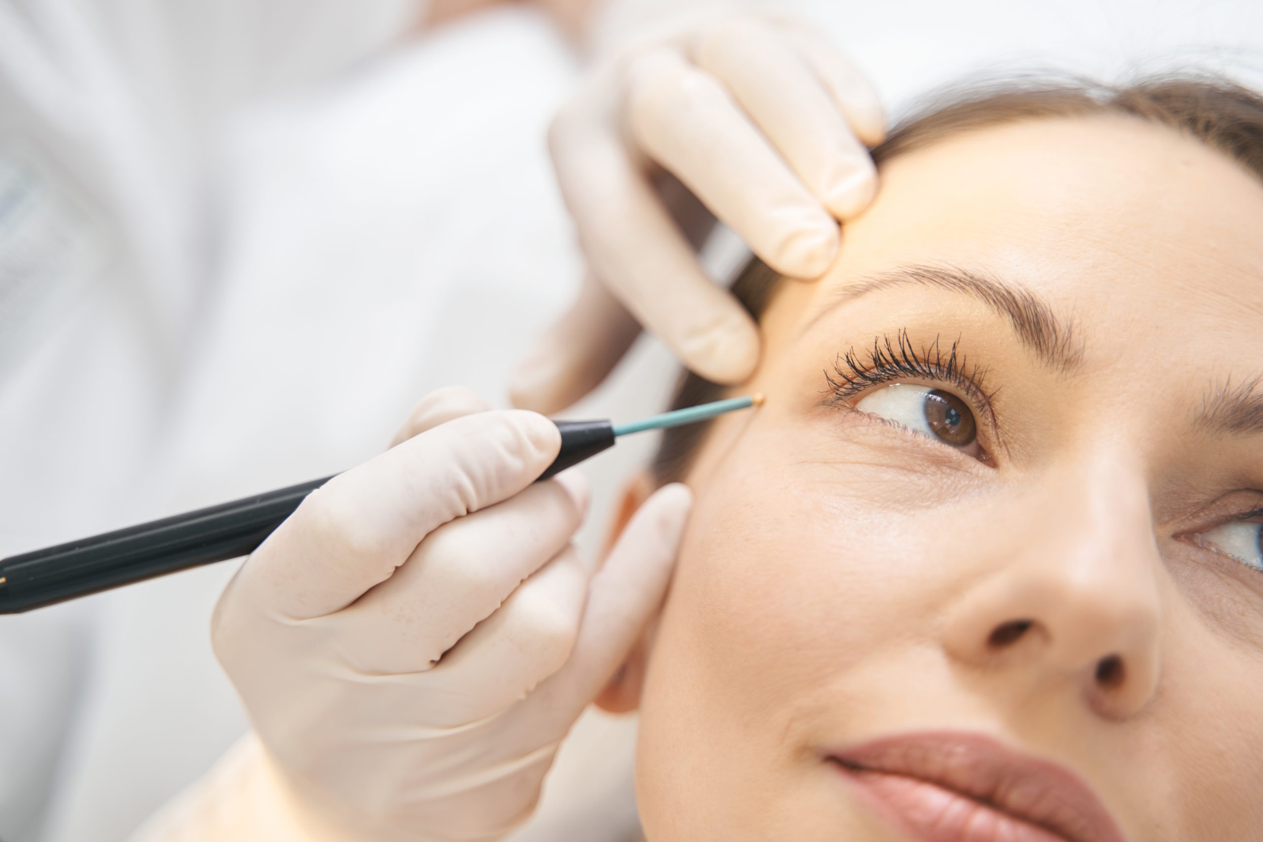 Dermatologist performing chemical peel session