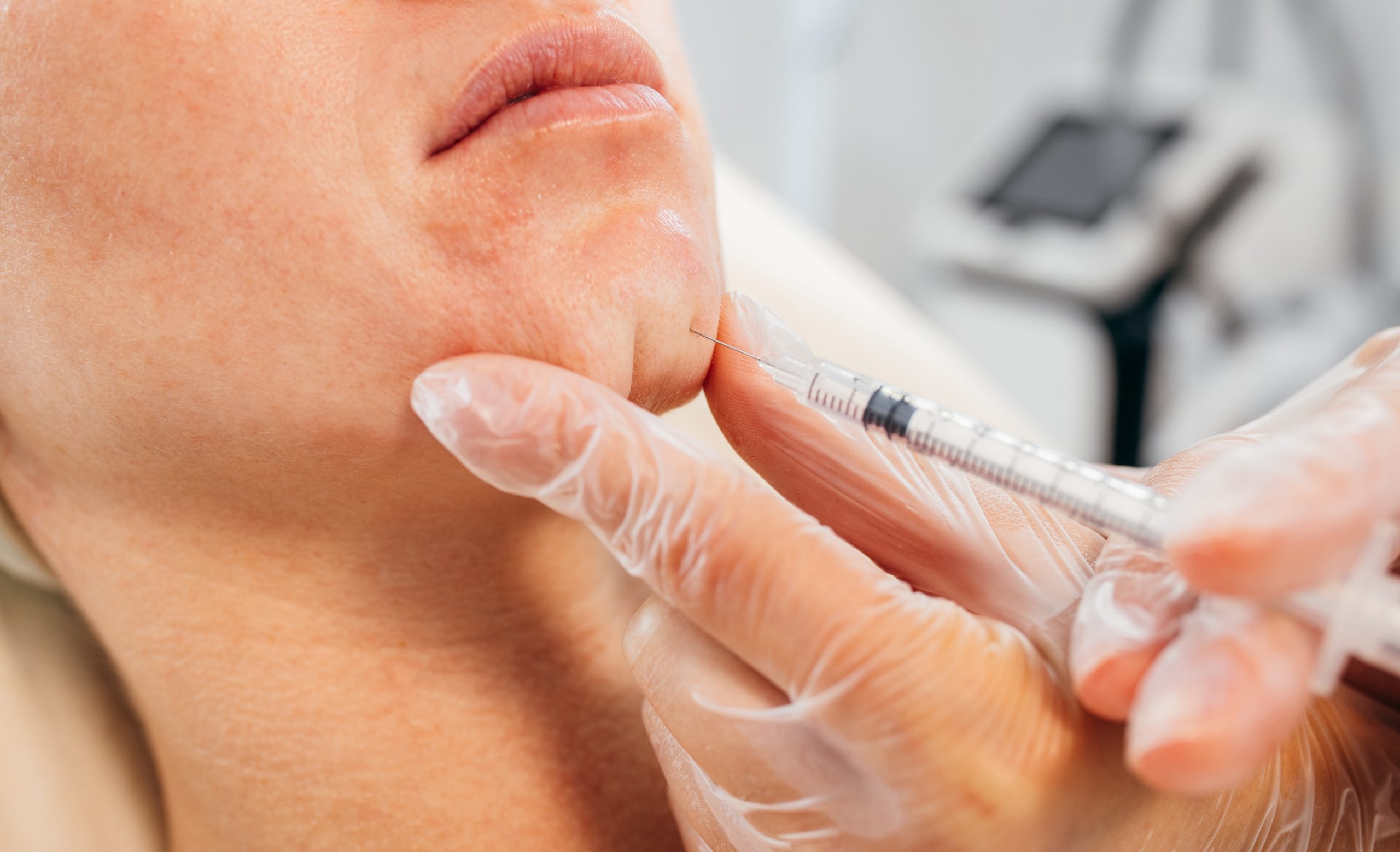 Laser skin treatment performed by specialist