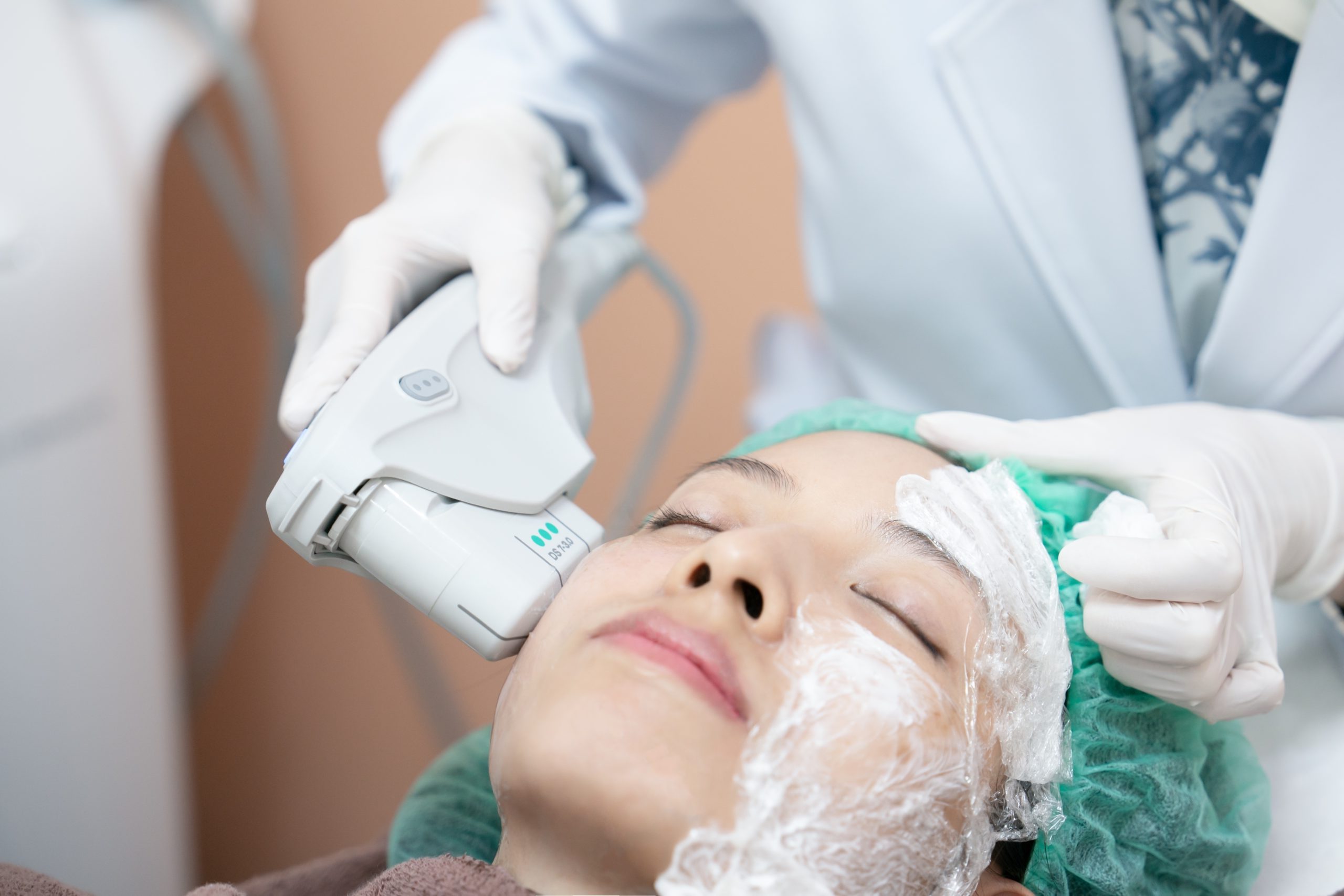 Laser resurfacing for fine lines reduction