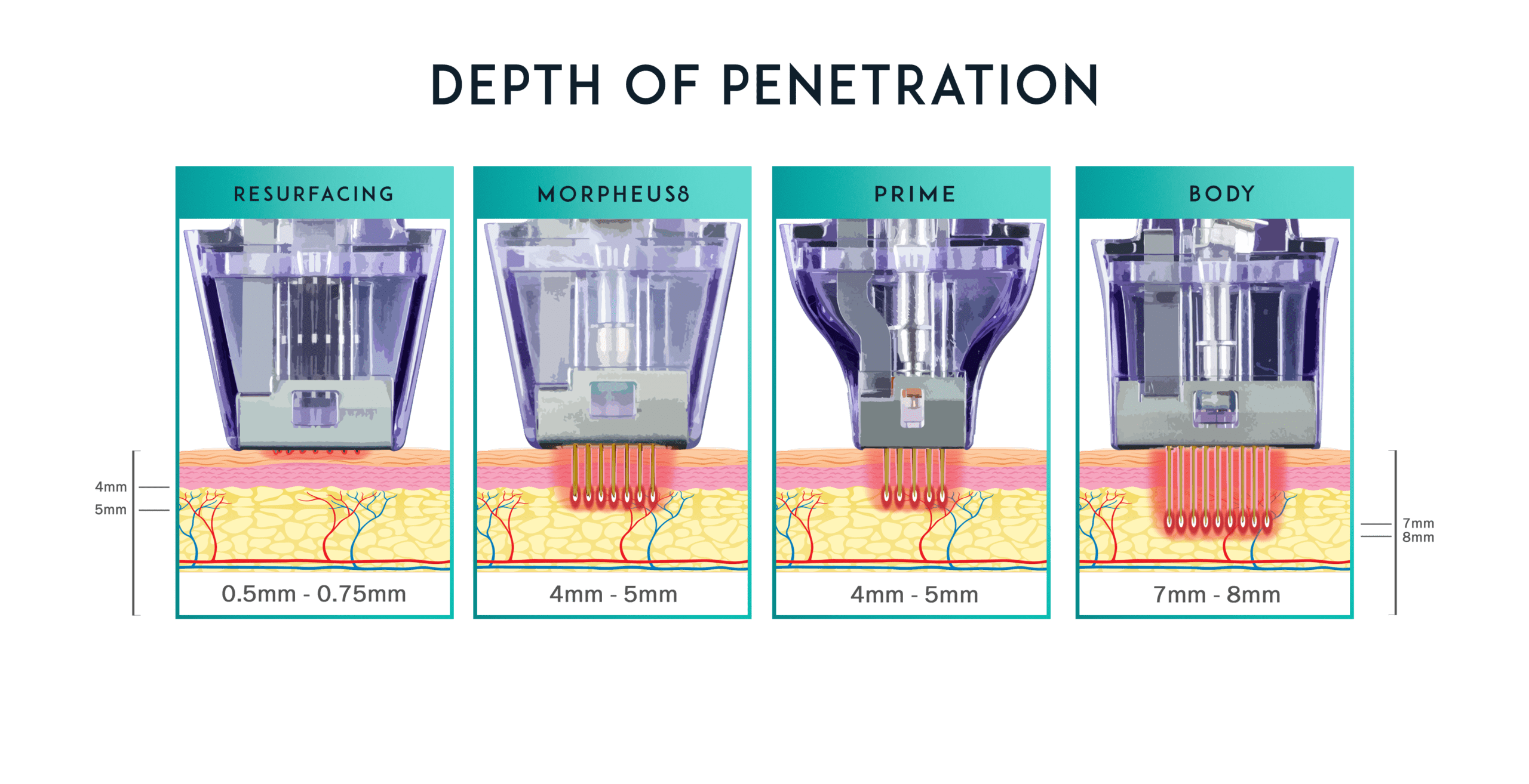 Morpheus8 radiofrequency microneedling layers graphic