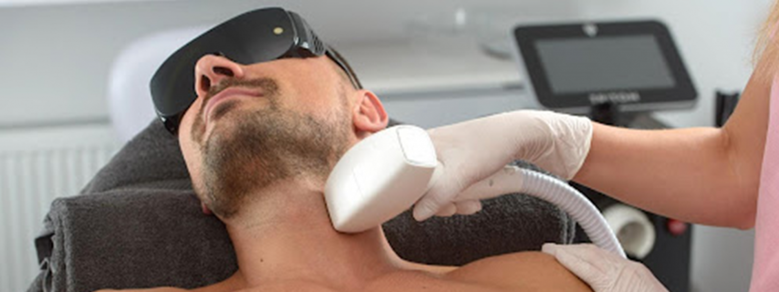 Laser hair reduction treatment